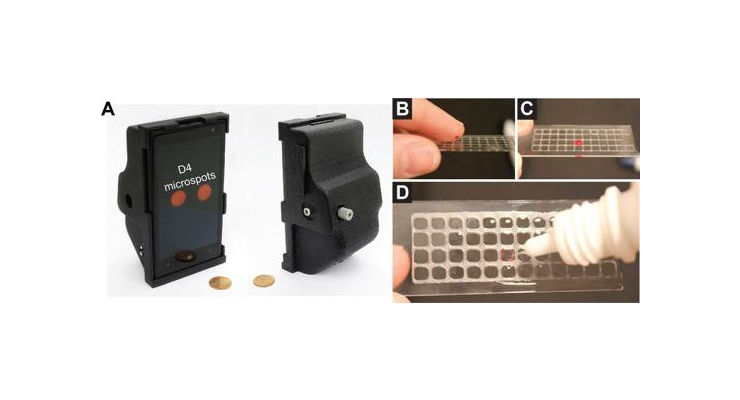 Printable Tool Enables 15-Minute Sensitive Diagnostic Testing - Medical ...