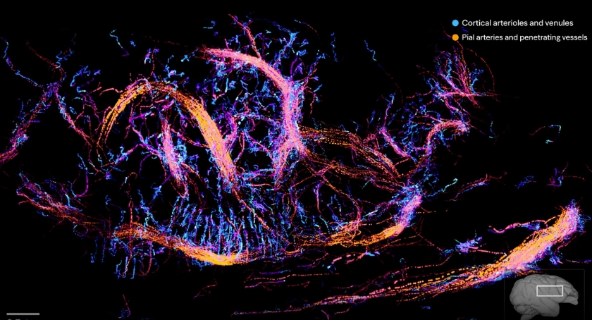 Aleph Neuro Unveils High-Res Brain Imaging Using Butterfly Network Tech